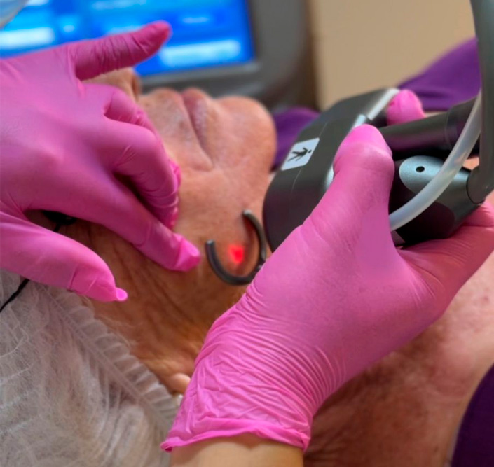 Foto Rejuvenescimento